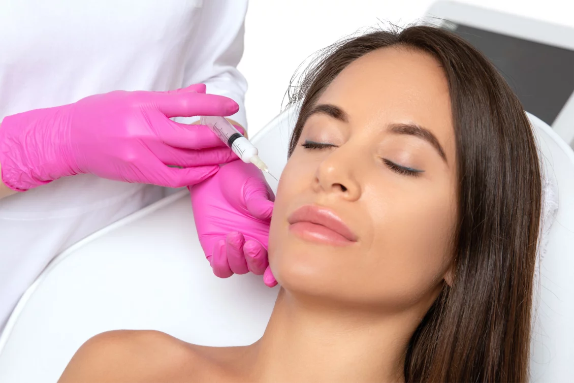 Faltenunterspritzung mit Hyaluronsäure in Berlin – sanfte Behandlung bei BellaDerma