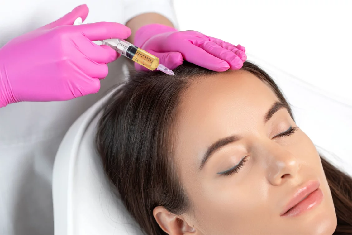 PRP Therapie gegen Haarausfall Berlin BellaDerma