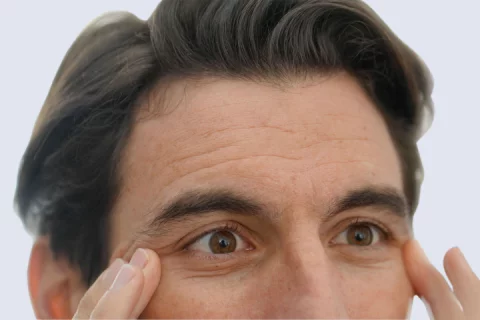  Botox against hair loss Berlin