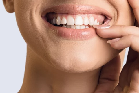 Gummy Smile treatment Berlin