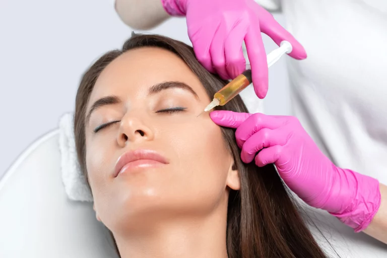  PRP therapy against dark circles under the eyes Berlin