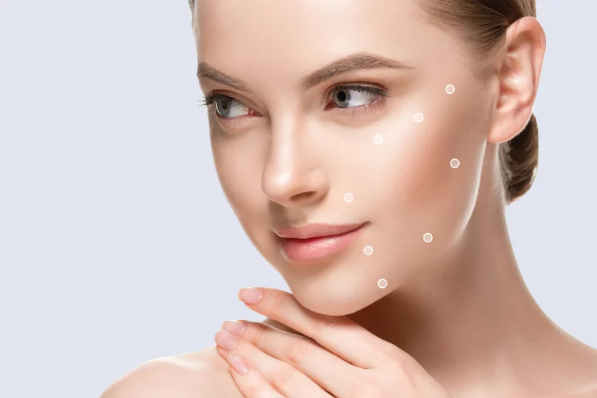 8 Punkte Lifting Berlin