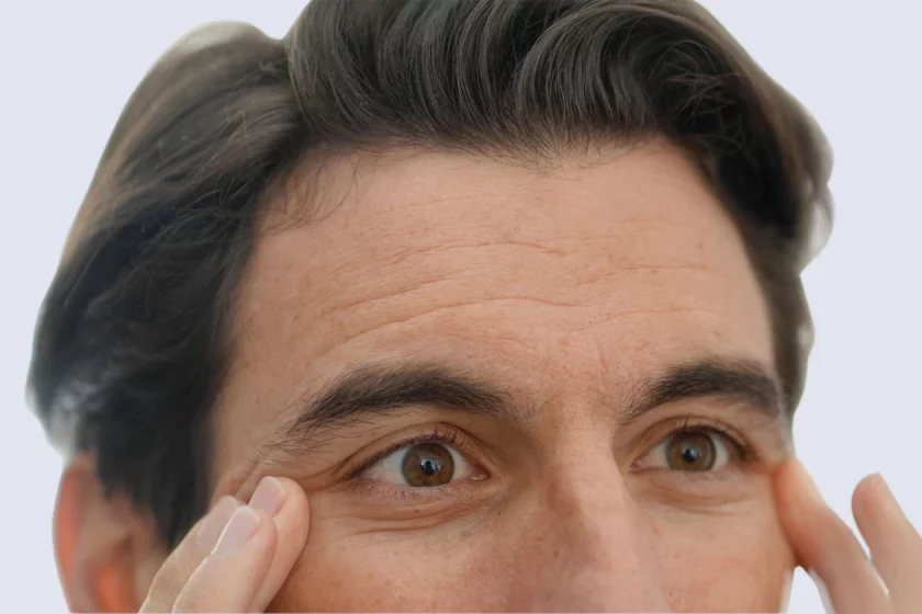 Botox gegen Haarausfall Berlin