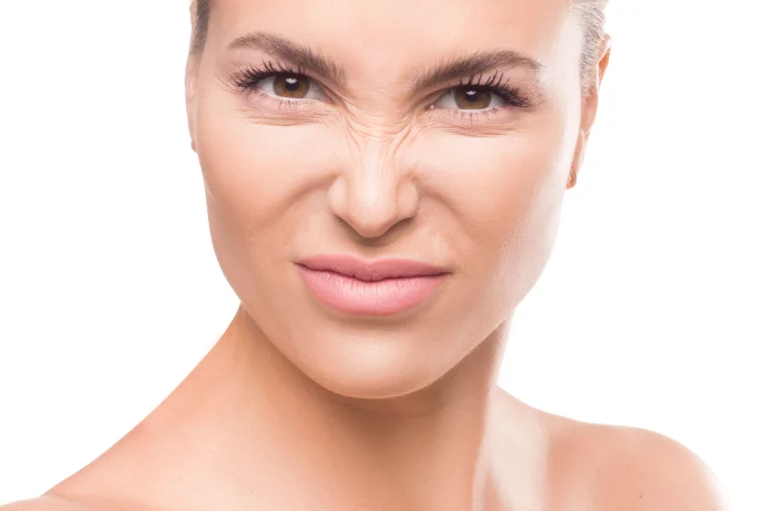 Bunny Lines Botox Belin