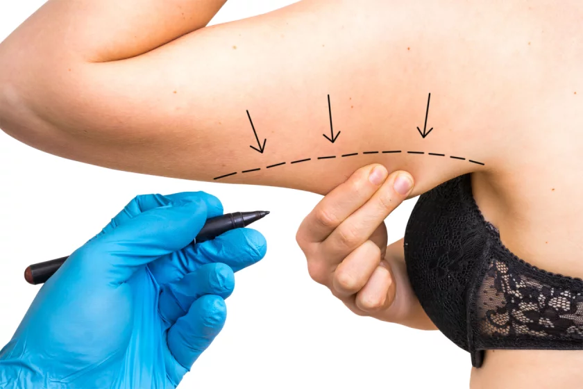 Tighten upper arms in Berlin