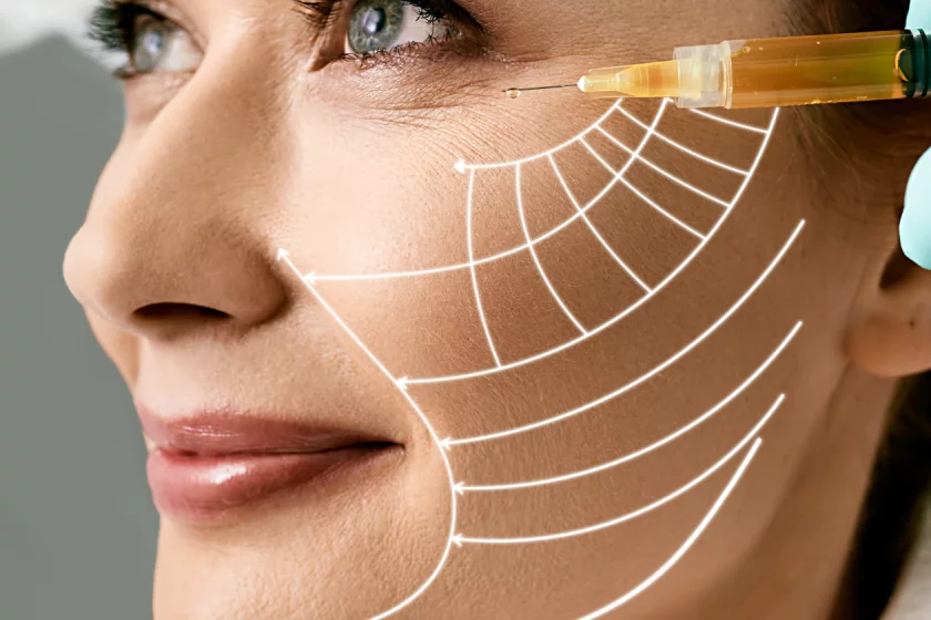 vampirlifting Berlin